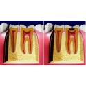 Endodonzia